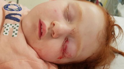 Melbourne toddler Katie was two when she fell onto a metal prong in a Target store.