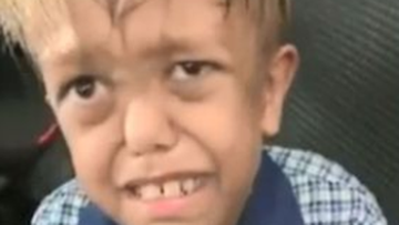 There has been an outpouring of support for Queensland boy Quaden Bayles, who has achondroplasia, after a heartbreaking Facebook video. 