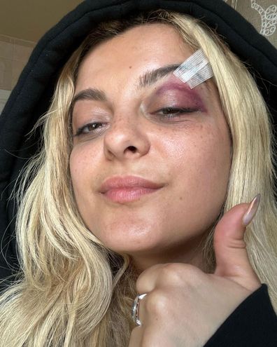 Bebe Rexha shares update for fans following assault on stage at concert.