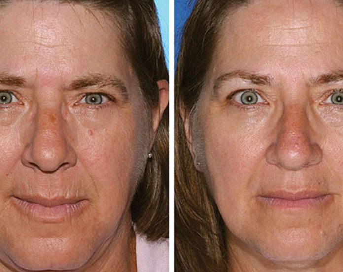 tobacco twins Identical twins study shows smokers age quicker