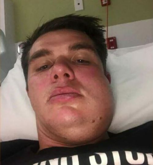 Carl Teusner is awaiting surgery for the broken jaw he sustained in the on-field violence.