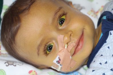 Baby Hunter became yellow due to a rare liver disease