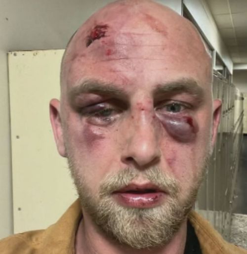 Spencer Goggin was left bloodied and bruised in a random attack while he was waiting for a taxi in Perth, with his attackers still on the run