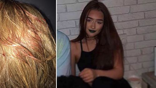 Manchester Arena explosion: Woman splattered by blood left haunted by lucky Ariana Grande 'bomb' escape