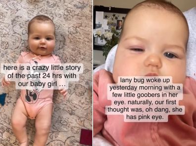 Mum Krisha's warning about baby's eye condition