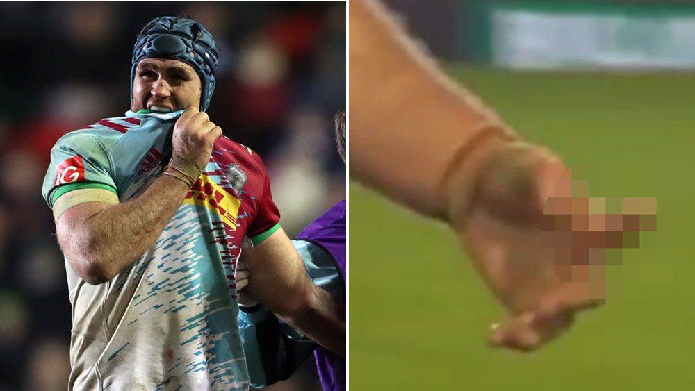 Horwill suffers horrific finger injury in England