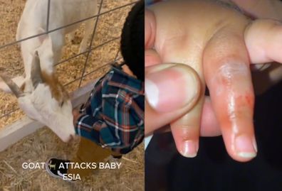 Goat bites little boys finger.