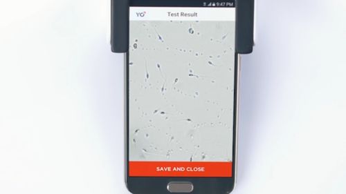 The app allows you to watch your sperm in an microscopic environment.