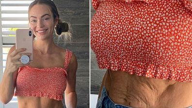 Emily Skye shows off ‘wrinkly tummy skin’ on Instagram.