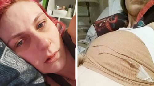 Melissa Harrison says she is in severe pain and has suffered numerous health problems since her breast implants were inserted.