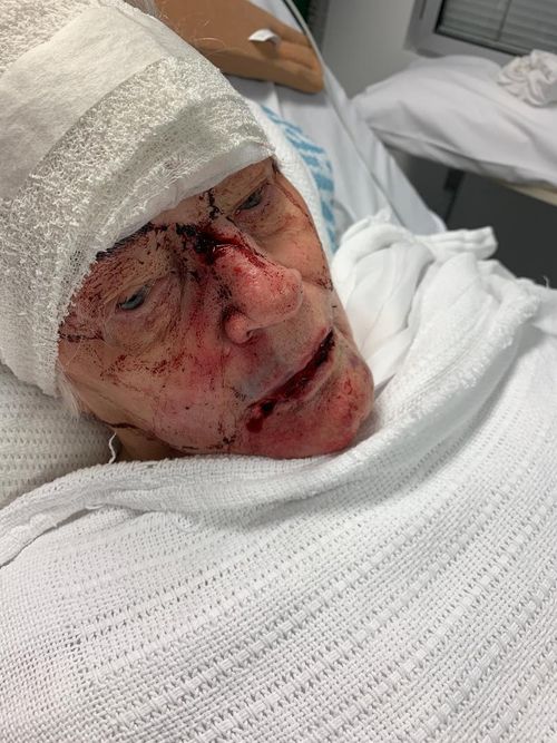 Patricia was beaten when she walked in on an intruder at her North Turramurra retirement village home.