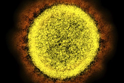 Coronavirus swab seen through microscope