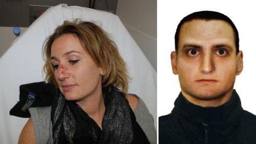 The woman (left) suffered a broken nose and arm, with police calling for the man pictured (right) to come forward and assist the investigation. (Victoria Police)