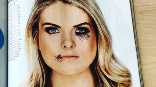 NRL Footy Show host Erin Molan fights domestic violence with confronting photo