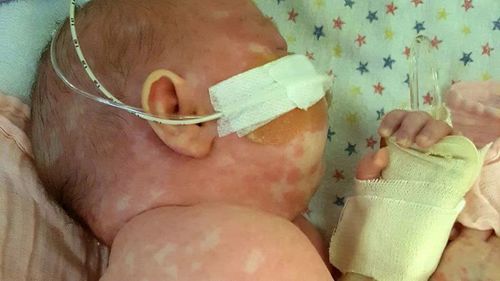 Georgia is pictured during her time in the paediatric intensive care unit (PICU) at Queensland Children's Hospital.