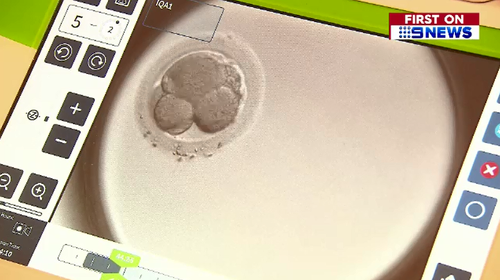 Parent's-to-be can now watch their embryo progress into a baby by logging n on their phone.