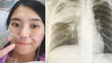 Mia Chen noticed no symptoms of her lung cancer until developing a persistent cough.