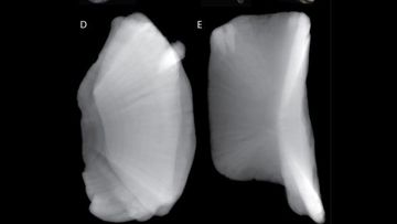 Vertebra from an ancient requiem shark showed two teeth embedded within them. (Perez, V.J. et al. Acta Palaeontological (2021); CC BY 4.0)