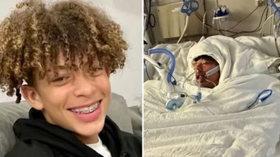 Teenager Mason Dark is in hospital with burns to 75 per cent of his body after attempting a TikTok challenge