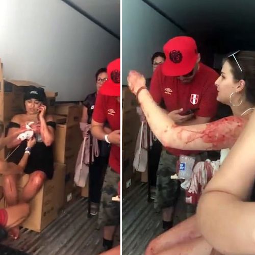 Wounded festival goers seek treatment in the aftermath of a deadly mass shooting in northern California: Image courtesy: Twitter via Robert Sandoval