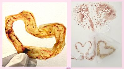 Umbilical cord art in the form of a preserved heart and a print. 