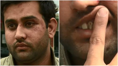 Melbourne cabbie suffers broken teeth after teens allegedly refused to pay fare