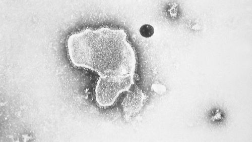 A human respiratory syncytial virus, also known as RSV.