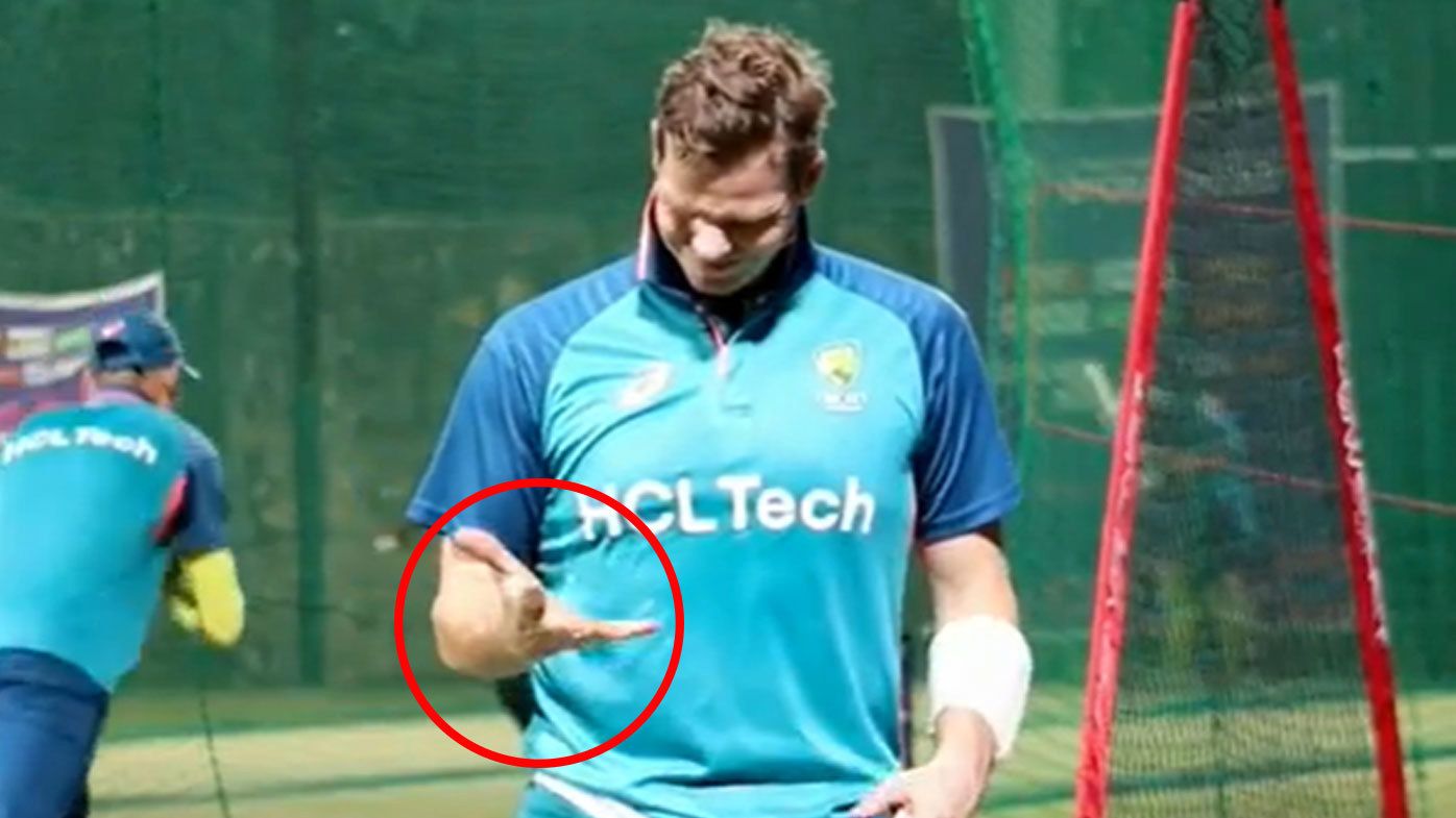 Steve Smith's hand left bleeding after copping vicious delivery in net session ahead of Netherlands clash