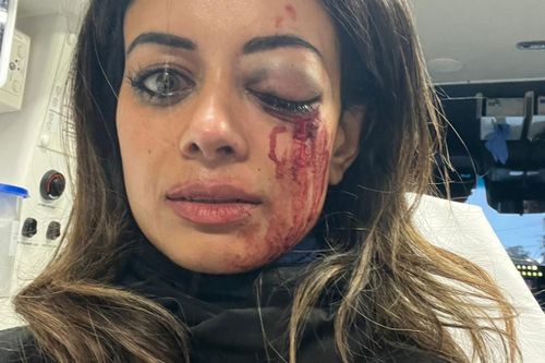 Hannah Thomas was badly injured following an anti-Israel protest in Sydney's west. 