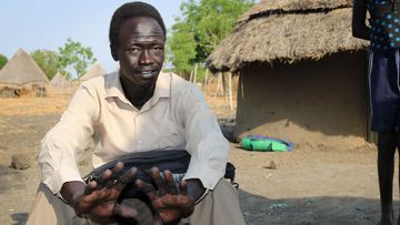 Deng Machar sits in his yard recounting the day his three children were abducted from his home. (AP)