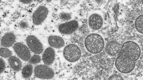 This electron microscopic (EM) image depicted a monkeypox virion, obtained from a clinical sample associated with the 2003 prairie dog outbreak. It was a thin section image from of a human skin sample. On the left were mature, oval-shaped virus particles, and on the right were the crescents, and spherical particles of immature virions. High Resolution:	Click here for hi-resolution image (5.21 MB) Content Providers(s):	CDC/ Cynthia S. Goldsmith Creation Date:	2003 Photo Credit:	Cynthia S. Goldsmi