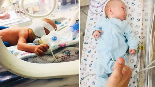 Jaxson O'Regan when he was in intensive care (left) and when he was moved to an open crib. (Supplied)