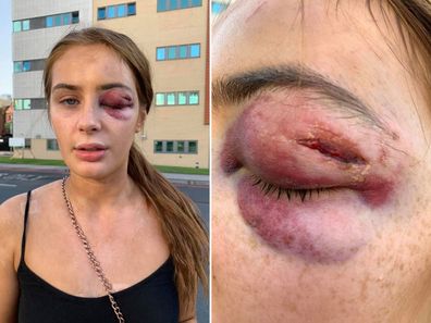 Teen attacked for turning down strangers' advances.