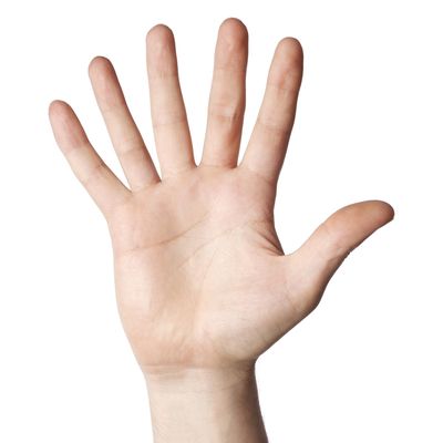 Polydactyly: Having six fingers