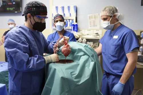 สมาชิกของทีมศัลยแพทย์โชว์หัวใจหมูเพื่อปลูกถ่ายผู้ป่วย David Bennett ในบัลติมอร์เมื่อวันศุกร์ที่ 7 ม.ค.