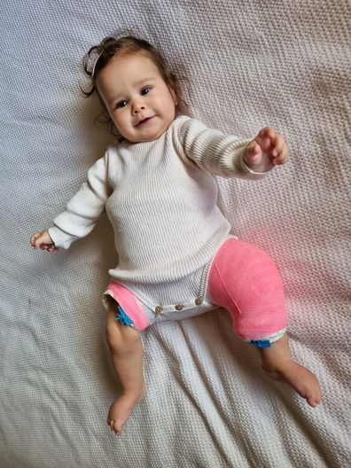 Eliana wearing her waterproof hip spica cast.