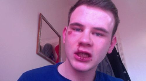Gay teen made up 'homophobic attack'