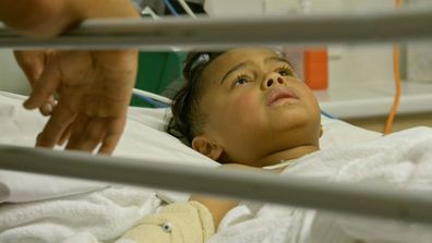 Children's Hospital Tuki nearly loses both of his legs after boat accident