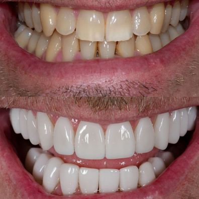 MAFS  Matt Ridley shows off teeth transformation 
