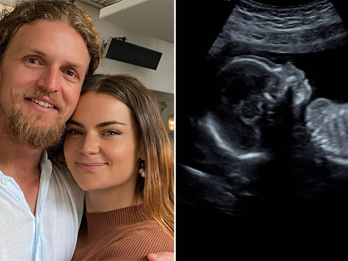Honey Badger Nick Cummins Is Having A Baby With Girlfriend Alexandra