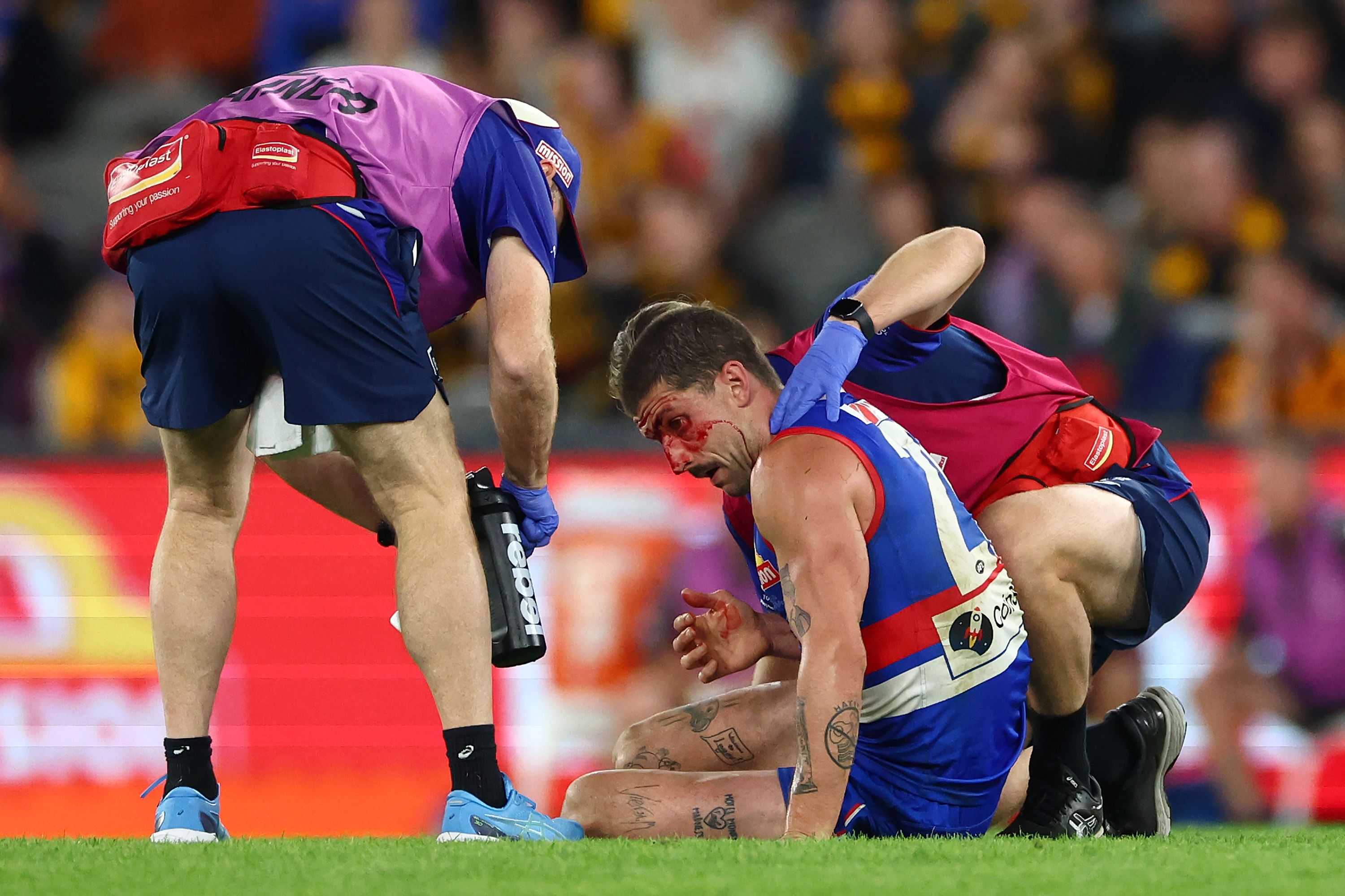 'I would be highly concerned': Tom Liberatore urged to consider retirement after fourth concussion in 12 months