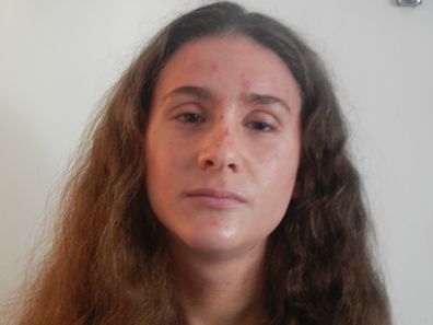 Rhiannon Grant lived with life-threatening allergies her entire life.