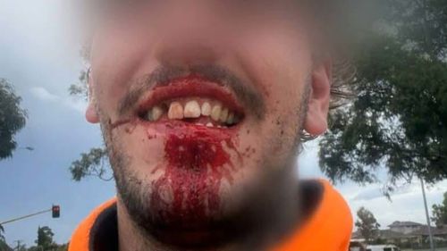 A tradie has recounted the moment he was brutally assaulted after an argument with another driver escalated. 