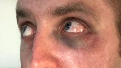 The police officer was left with significant bruising, pain and swelling to his face and cuts to his mouth.

