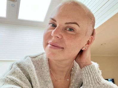 Keely Langshaw lost her hair in the process of cancer treatment.