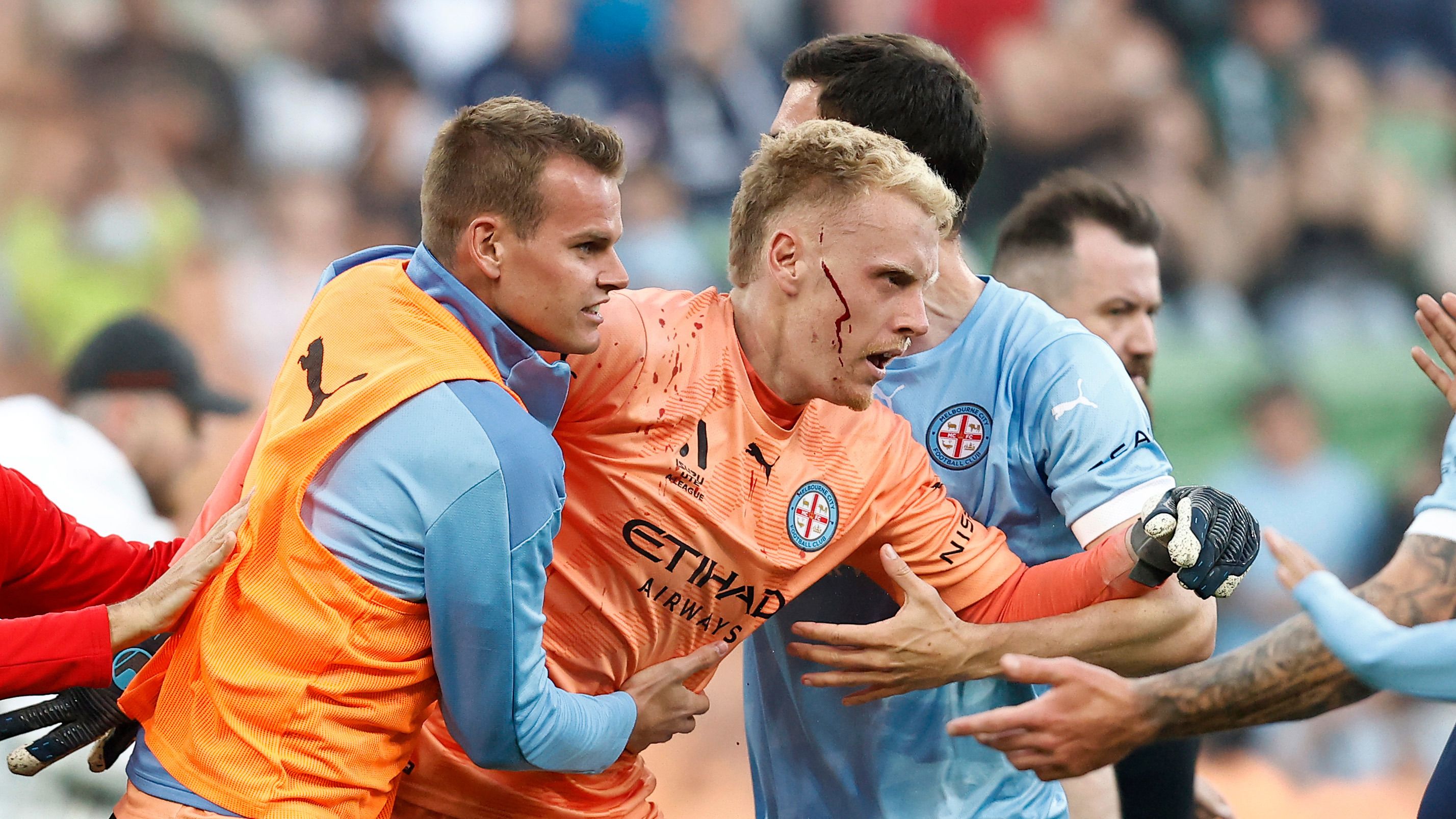 A bleeding Tom Glover of Melbourne City is escorted from the pitch by team mates after fans stormed the pitch during the round eight A-League Men&#x27;s match between Melbourne City and Melbourne Victory at AAMI Park, on December 17, 2022, in Melbourne, Australia. (Photo by Darrian Traynor/Getty Images)