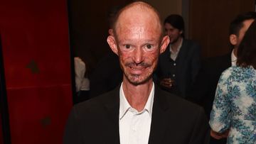 Darren Kent