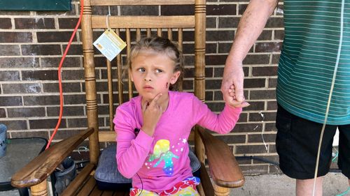 Kinsley White shows reporters a wound left on her face