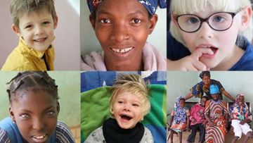 The faces of some of the children taking part in undiagnosed diseases programs.