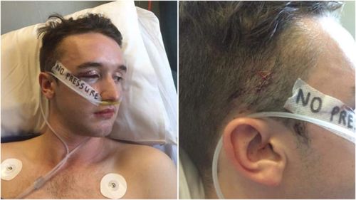 Andrew McNab was sickened and walked out of court when he heard the sentence handed to his attacker Rhyce Butcher Corney.